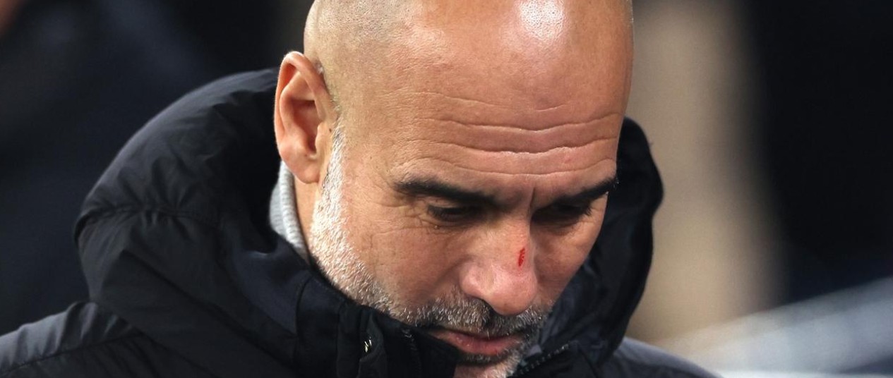 Pep Guardiola Aclara la Razón de sus Heridas en la Cara